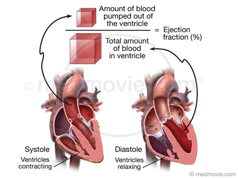 fraction of 27|ejection fraction of 27.